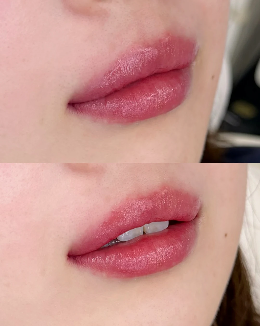 Rosepinkのリップアートメイク症例